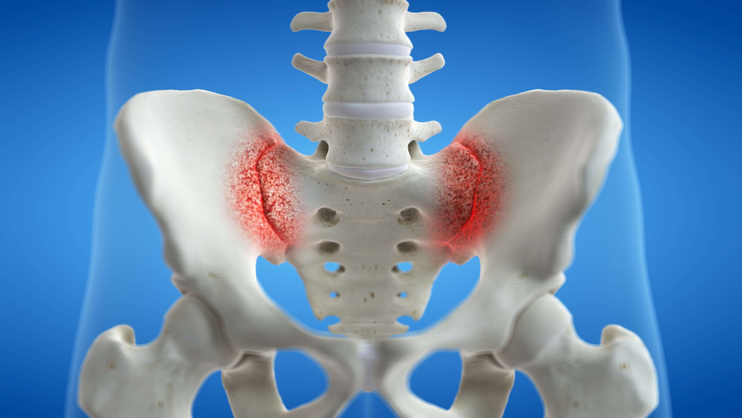 Nutrition Spur Does SI Joint Movement Cause Hip and Low Back Pain